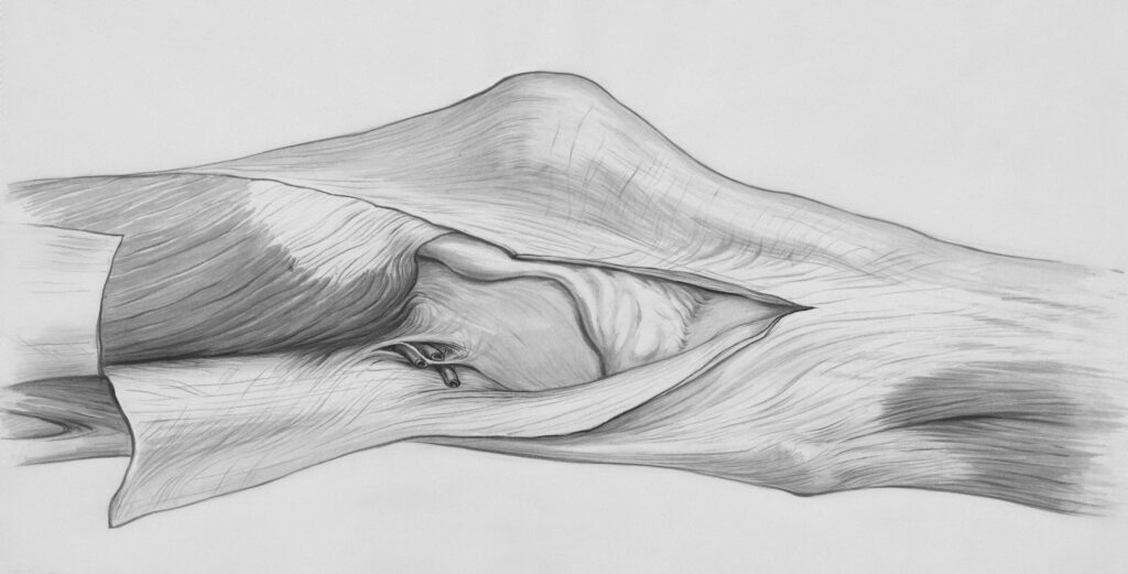 A Runner's Guide to Runner's Knee: Keeping Your Running Pain-free 2 europeana Q2Gjzg9DXfA unsplash