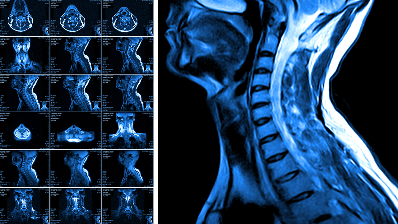 To Scan or Not to Scan: Is it Always Medically Necessary?