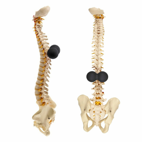 Bakphysio Bakballs Shown in Position on Skeleton of Spine