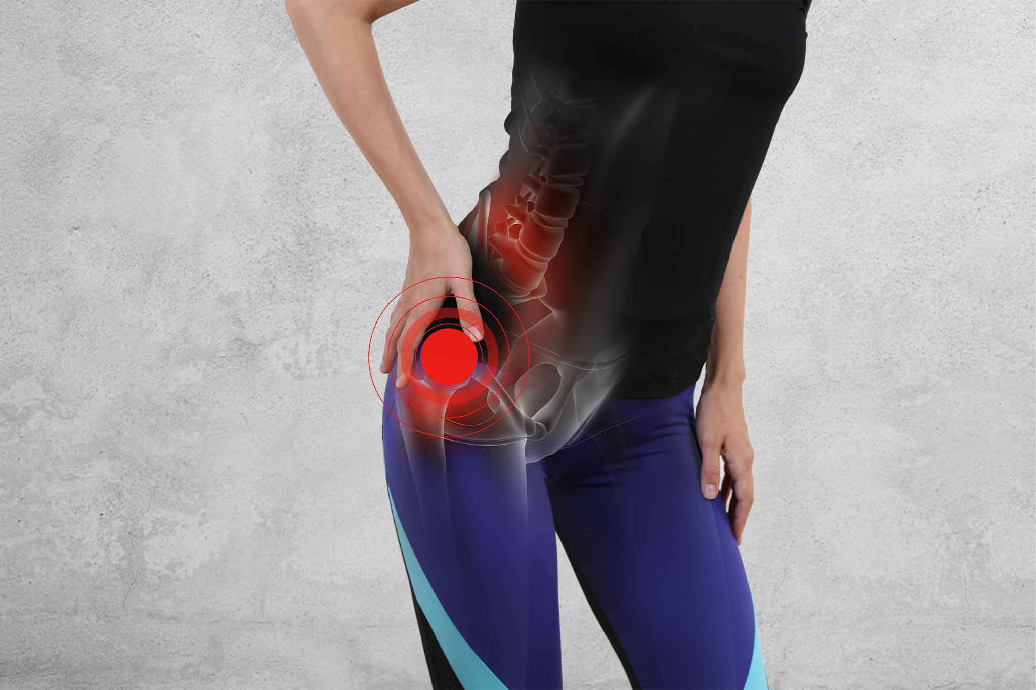 Chronic Hip Pain And How You Can Manage It